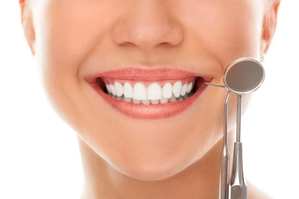 Clareamento Dental